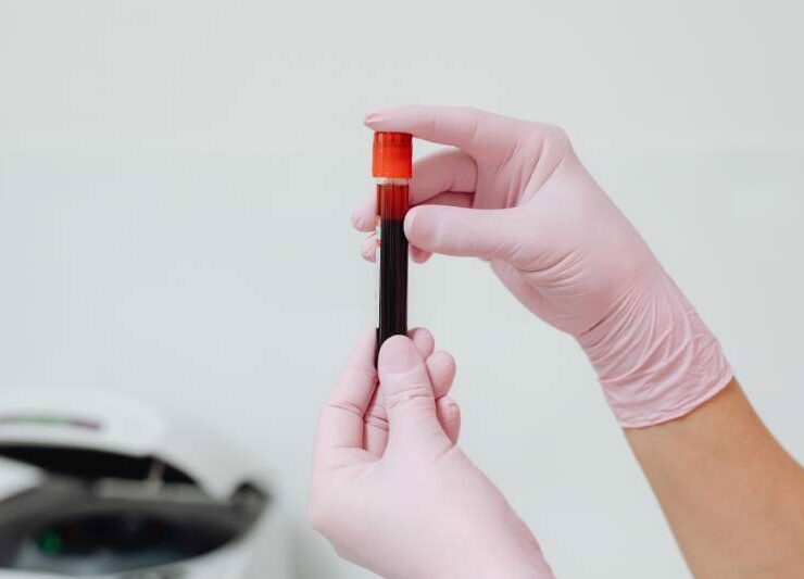 konflikt serologiczny