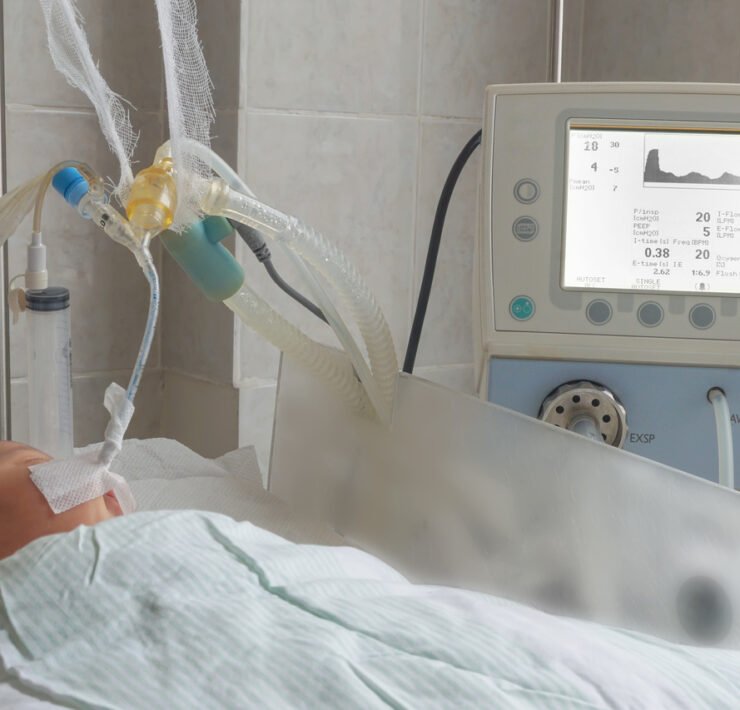 niemwolę leży w szpitalu na oddziale intensywnej terapii