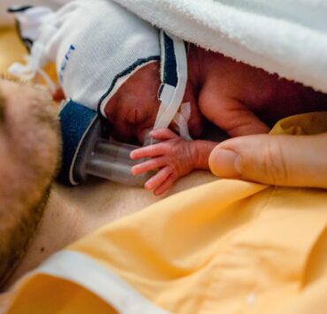 Kangurowanie wcześniaka na wspomaganiu