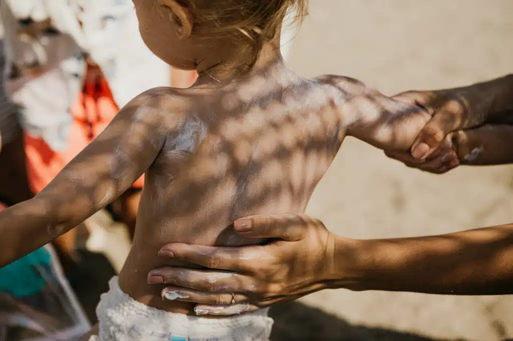 Rodzic nakłada krem z filtrem przeciwsłonecznym na plecy dziecka podczas pobytu na plaży – ochrona UV dla najmłodszych.