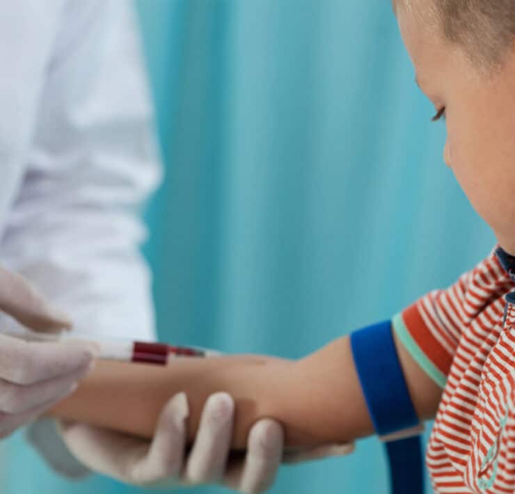 pielęgniarka pobiera dziecku krew na badanie CRP
