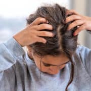 młoda dziewczyna z łupieżem