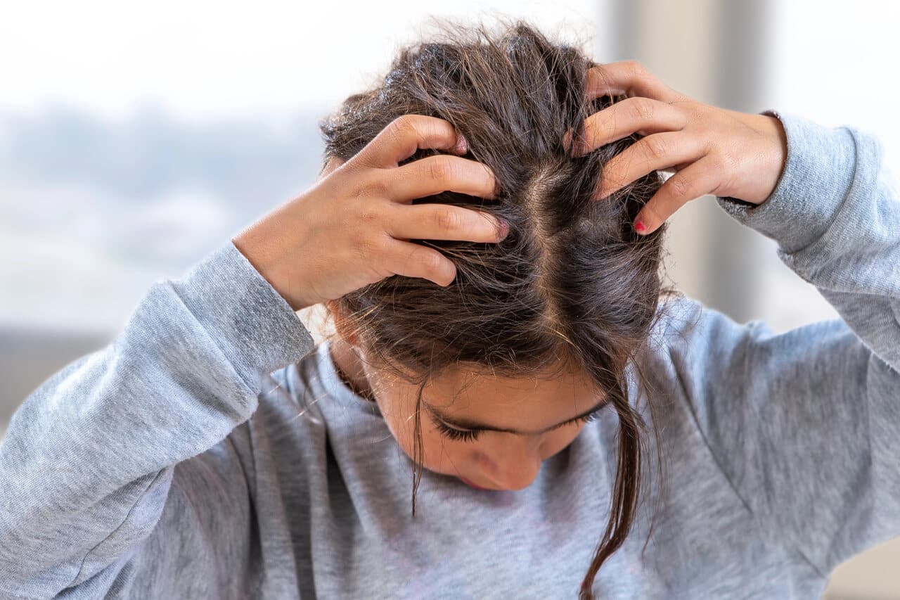 młoda dziewczyna z łupieżem