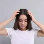 Nastolatka z łupieżem