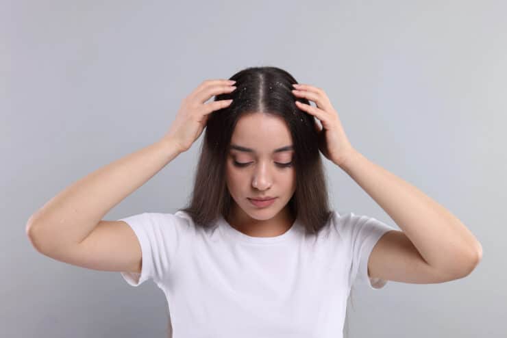 Nastolatka z łupieżem